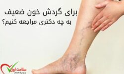 برای گردش خون ضعیف به چه دکتری مراجعه کنیم؟
